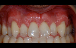 Smile Gallery - Before and After 19